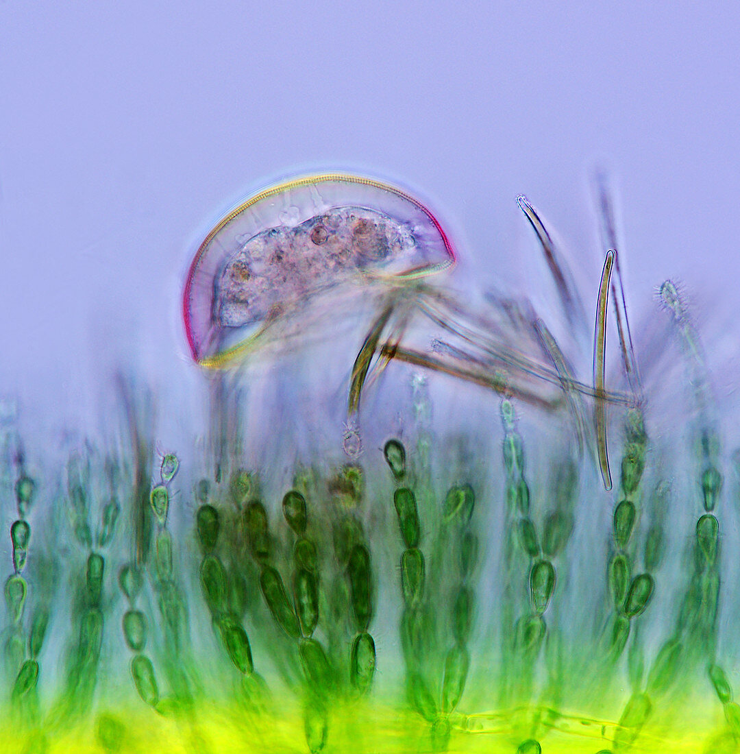 Amoeba,diatoms and red algae,micrograph