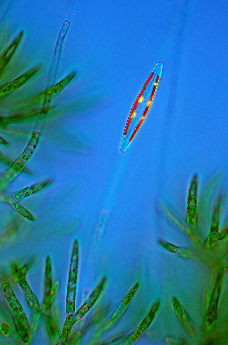 Diatom and green algae,micrograph