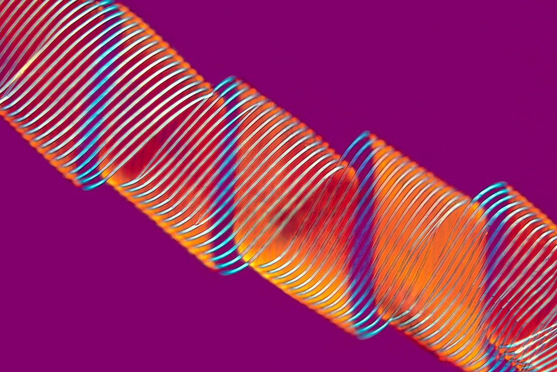 Spiral vessel,polarised light micrograph