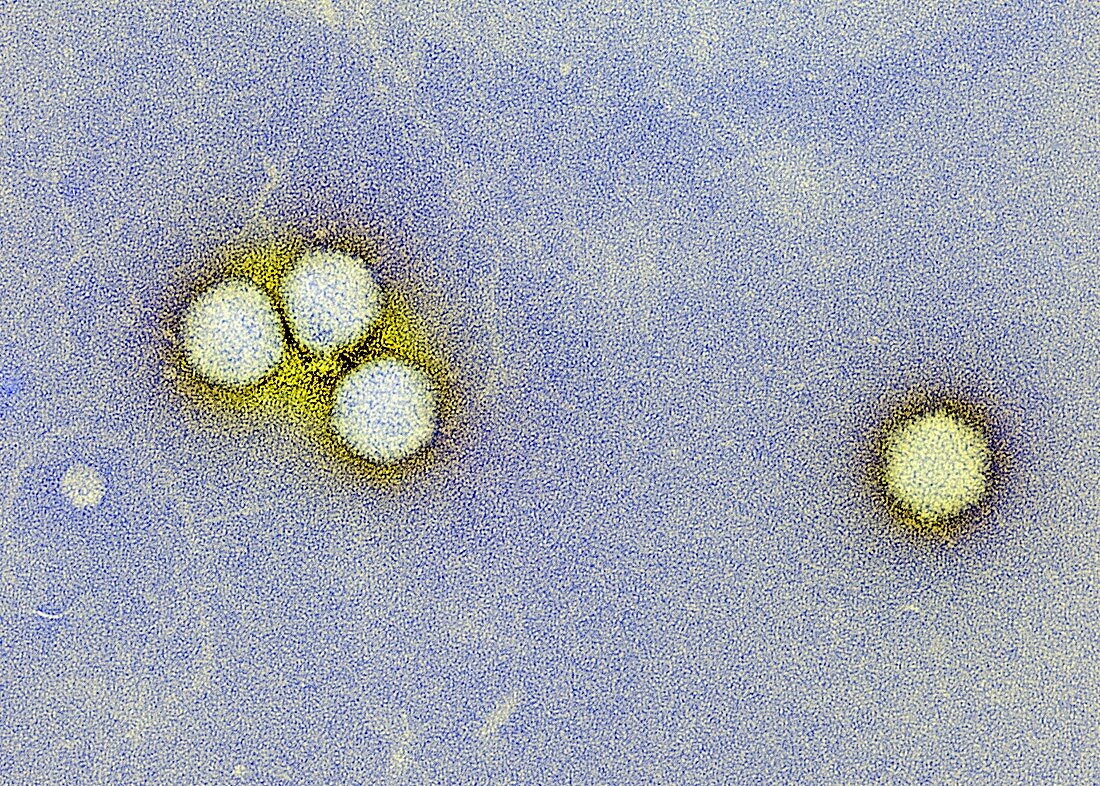 Adenovirus particles,TEM