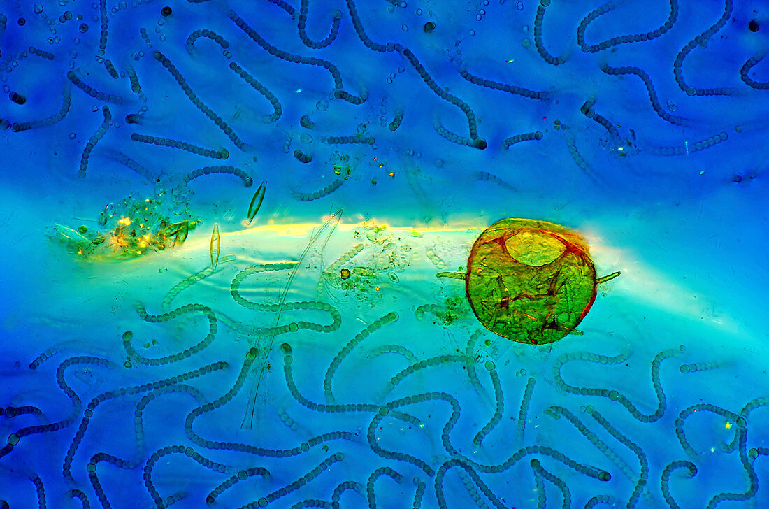 Cyanobacteria and amoeba,micrograph