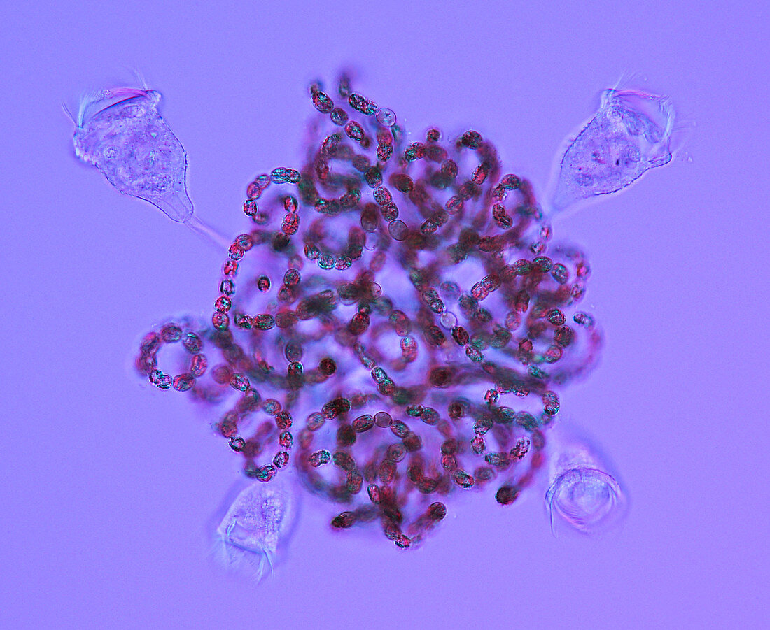 Cyanobacteria and protozoa,micrograph