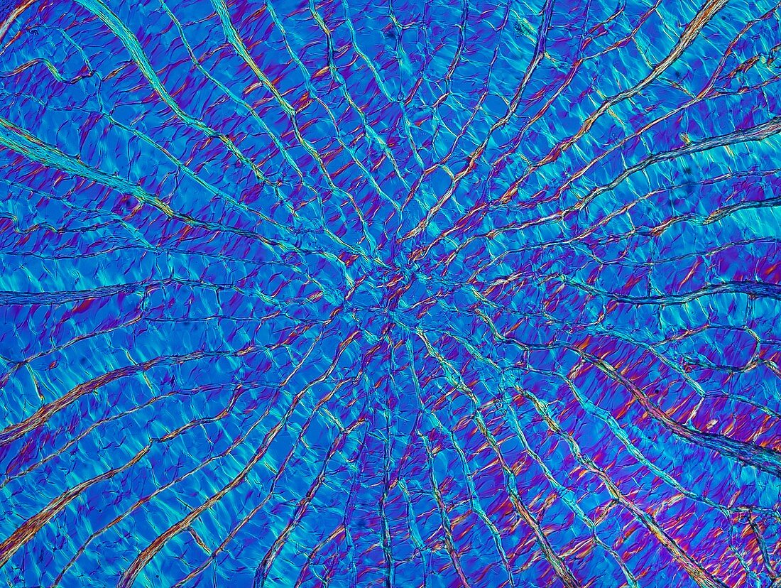 Porcupine quill,light micrograph