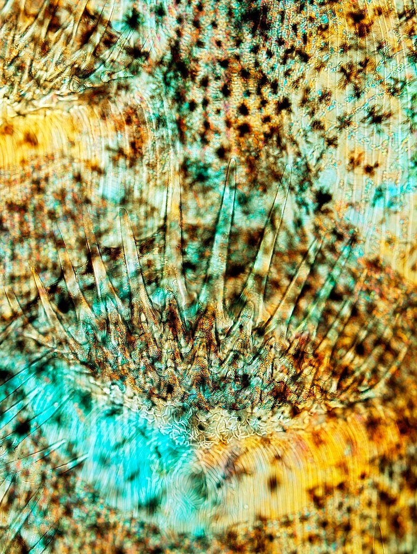 Sole skin,polarised light micrograph