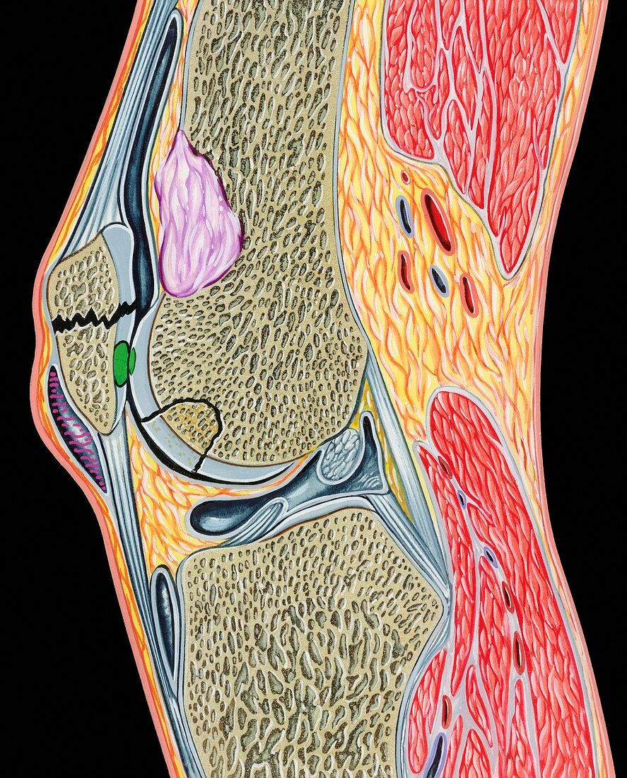 Knee joint disorders,illustration
