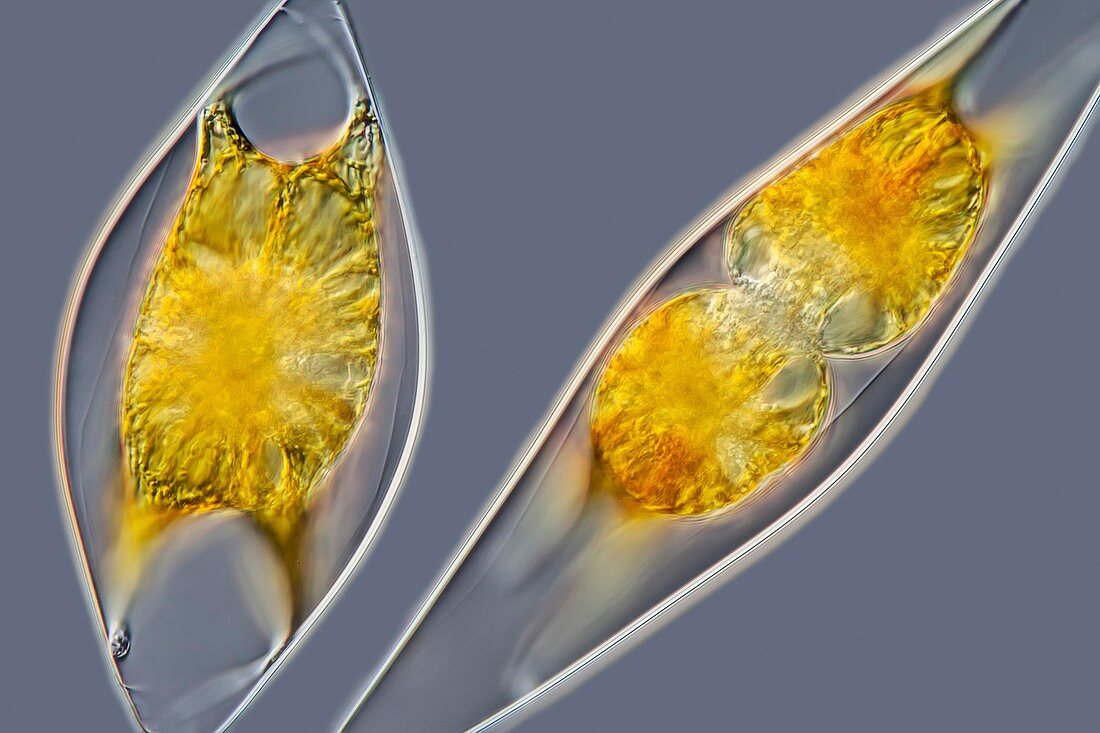 Pyrocystis lunula dinoflagellate,LM