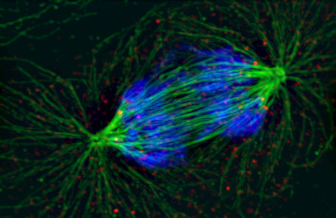 Epithelial cell in anaphase of mitosis