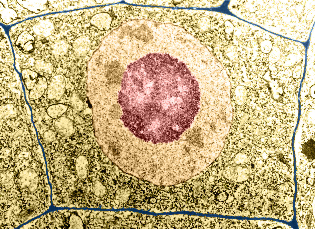 Normal cell