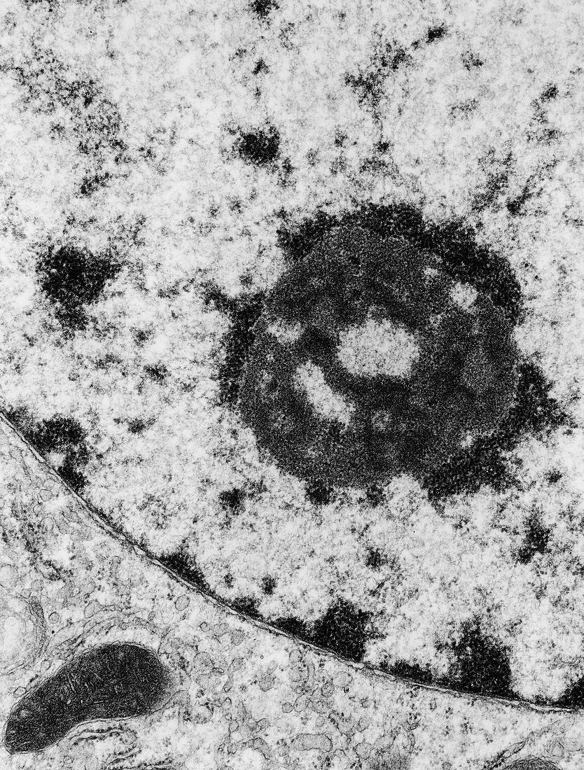 TEM,nucleolus in a nucleus of a cell