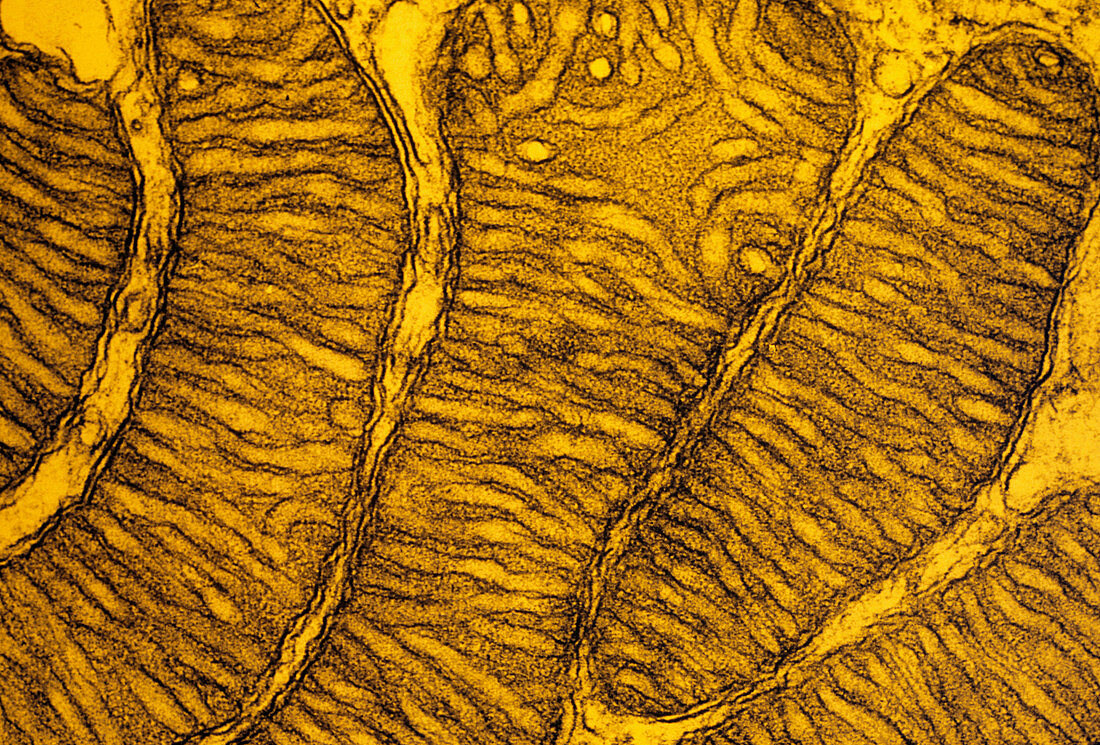 False-col TEM of mitochondria from hampster