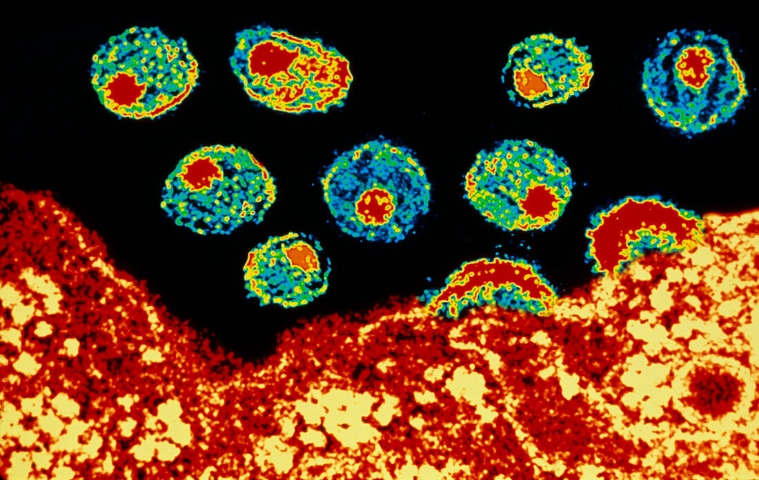 Coloured TEM of HIV-1 viruses budding from T-cell