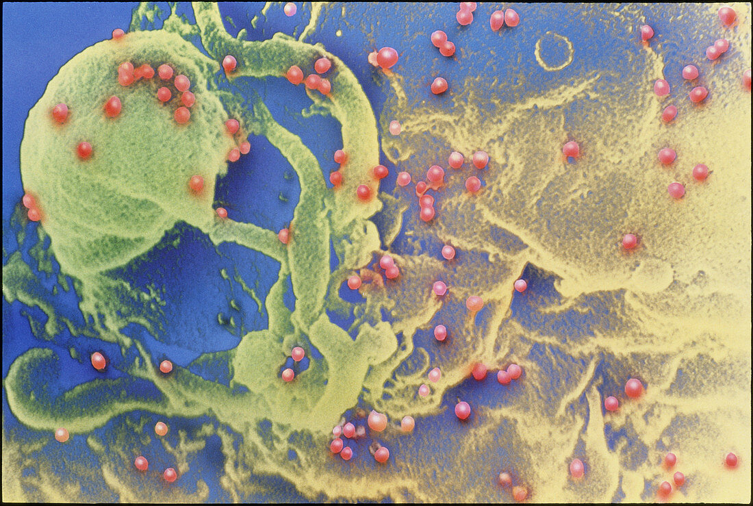 Coloured SEM of AIDS viruses on a white blood cell