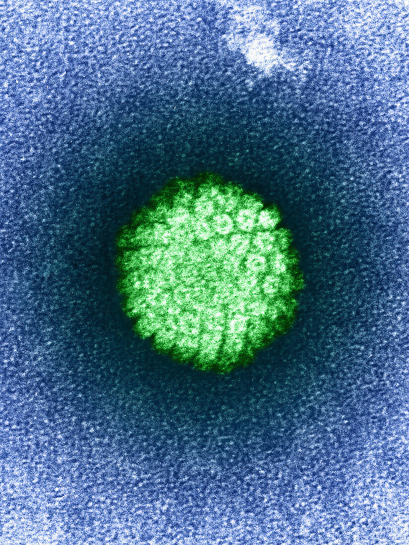 Herpes virus particle,TEM