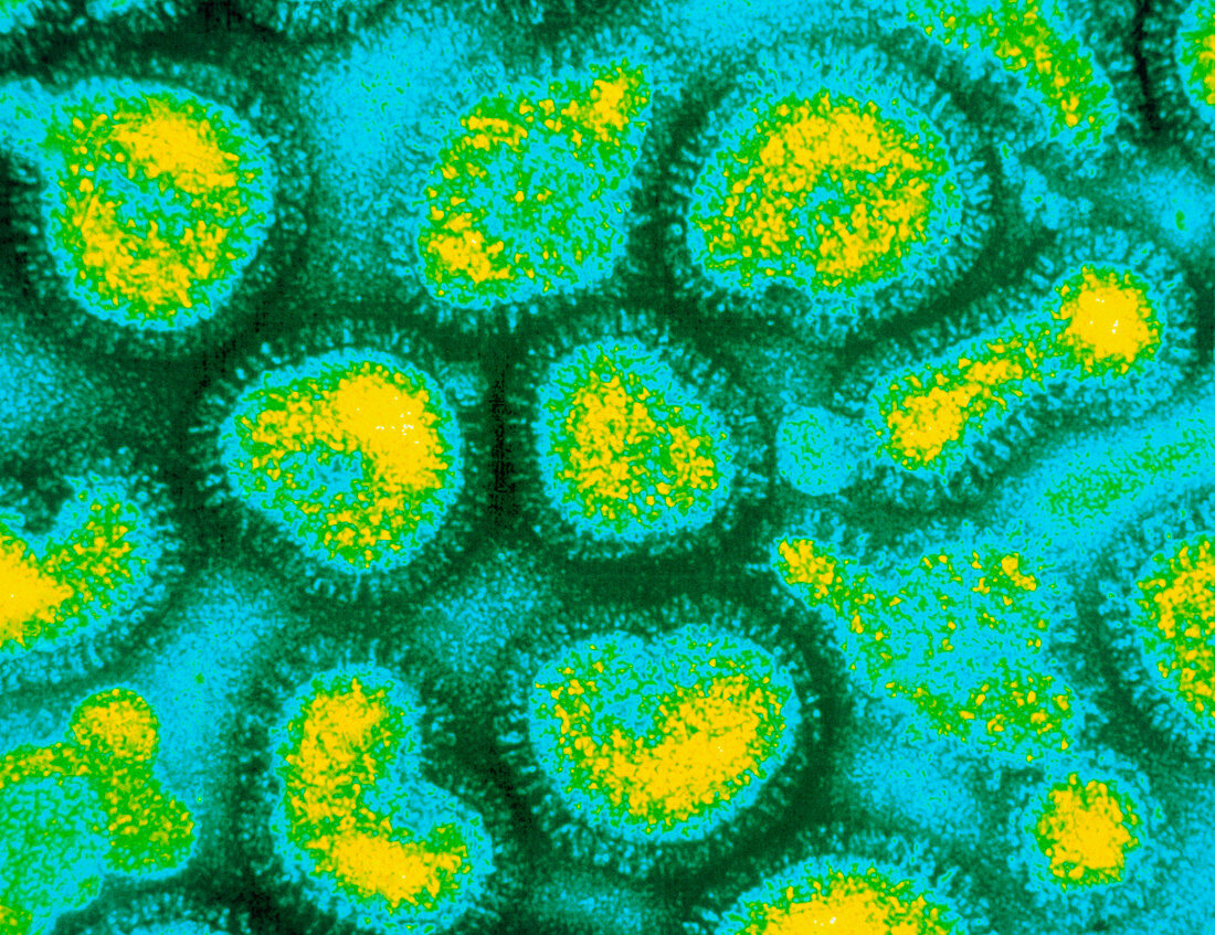 False-colour TEM of a cluster of influenza viruses