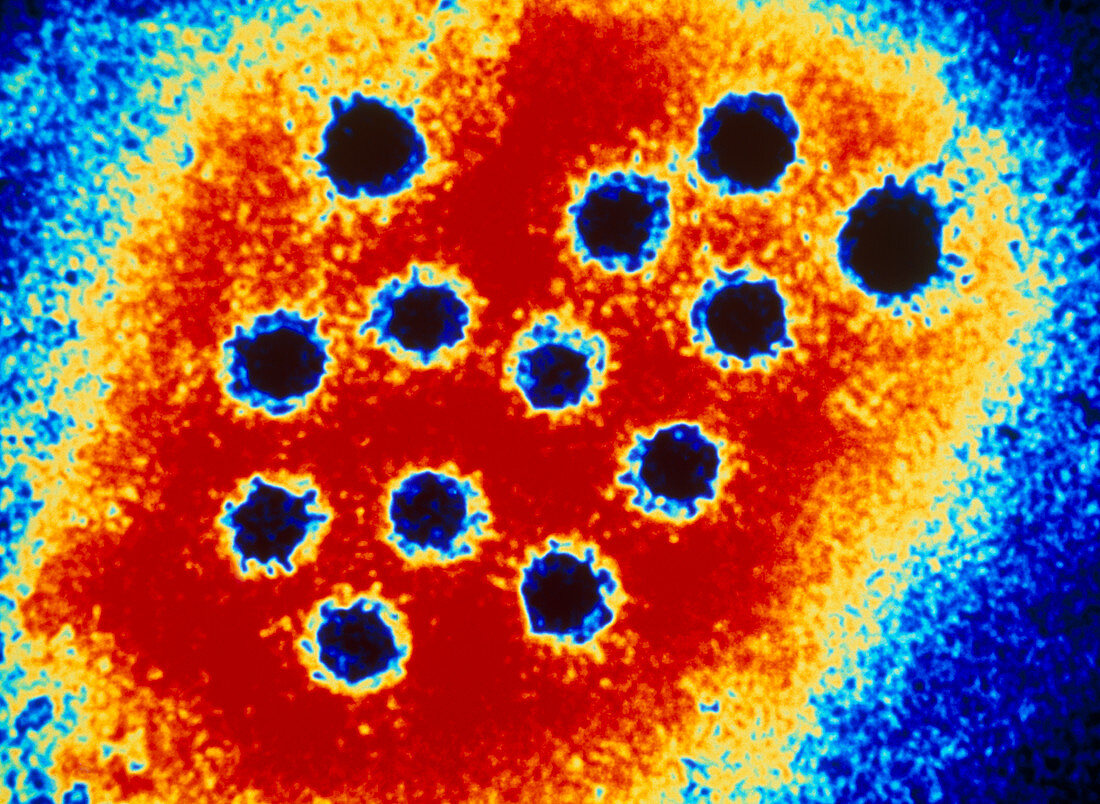 Coloured TEM of hepatitis A virus particles
