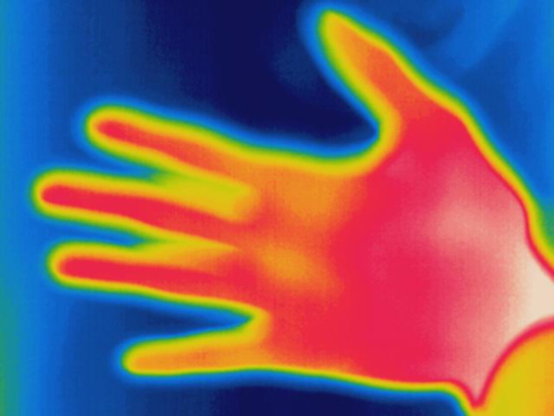 Thermogram of human hand