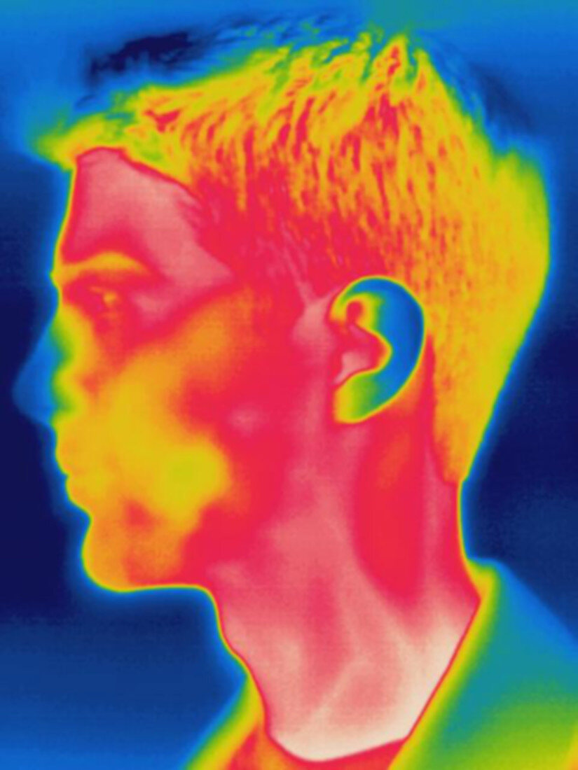 Thermogram of a mans face