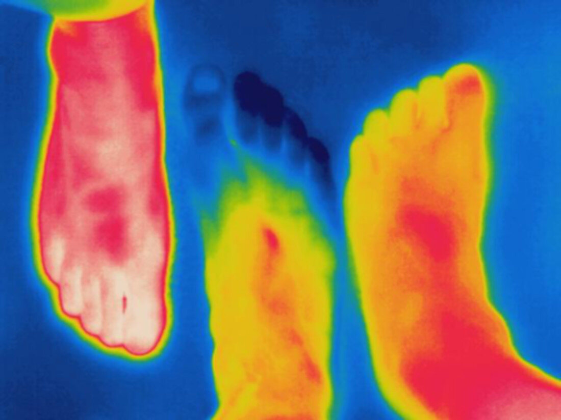 Thermogram of circulation in feet