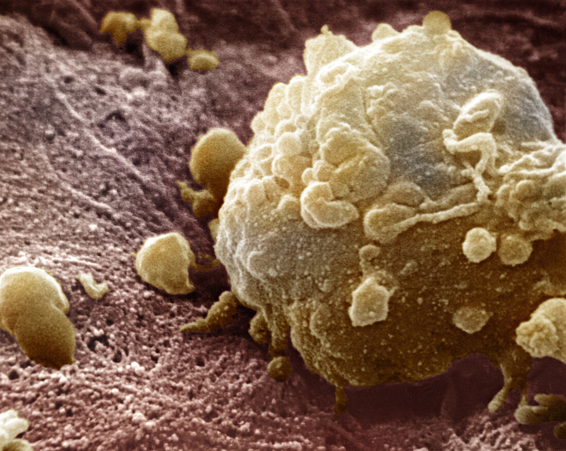 Melanoma Cell
