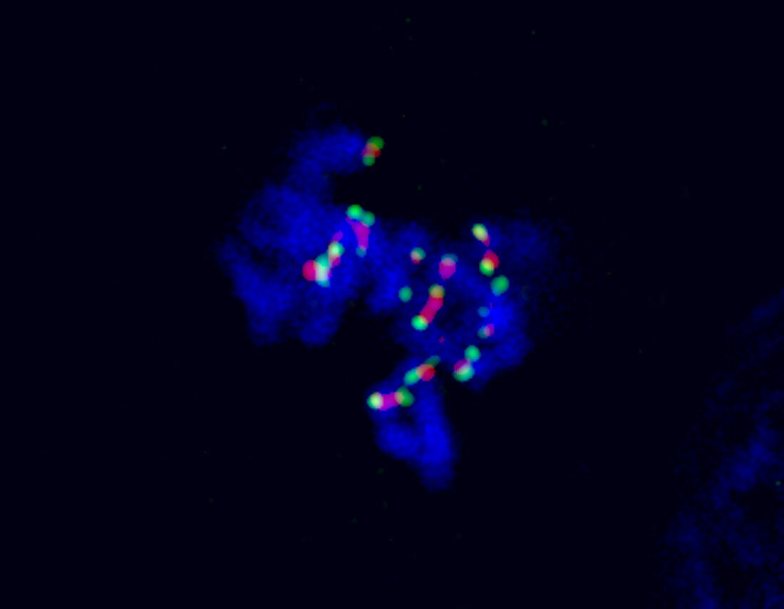 Human cancer cell in prometaphase