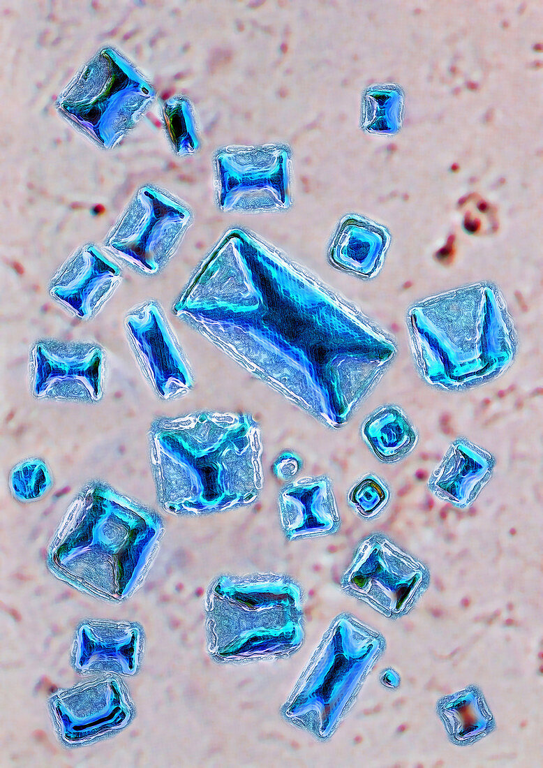 Calcium Oxalate