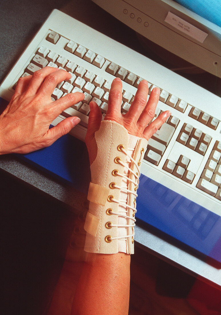 Repetitive strain injury