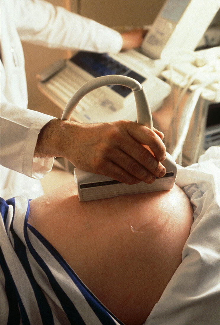 Doctor performing ultrasound scan