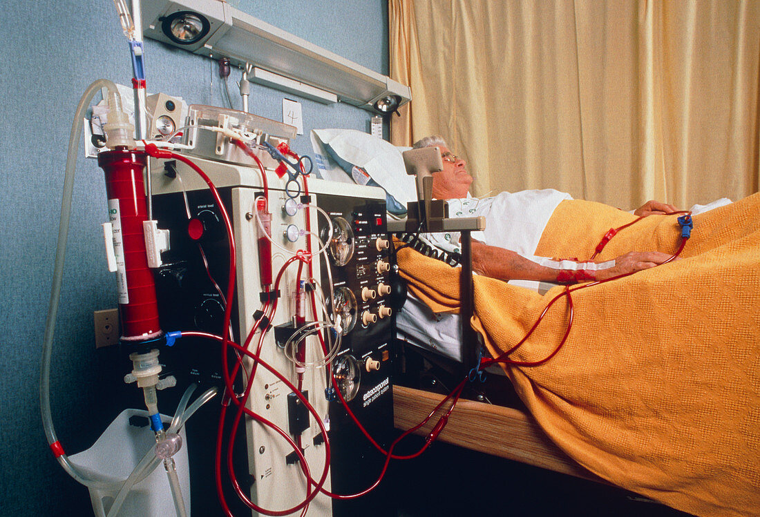 Elderly man undergoing renal dialysis