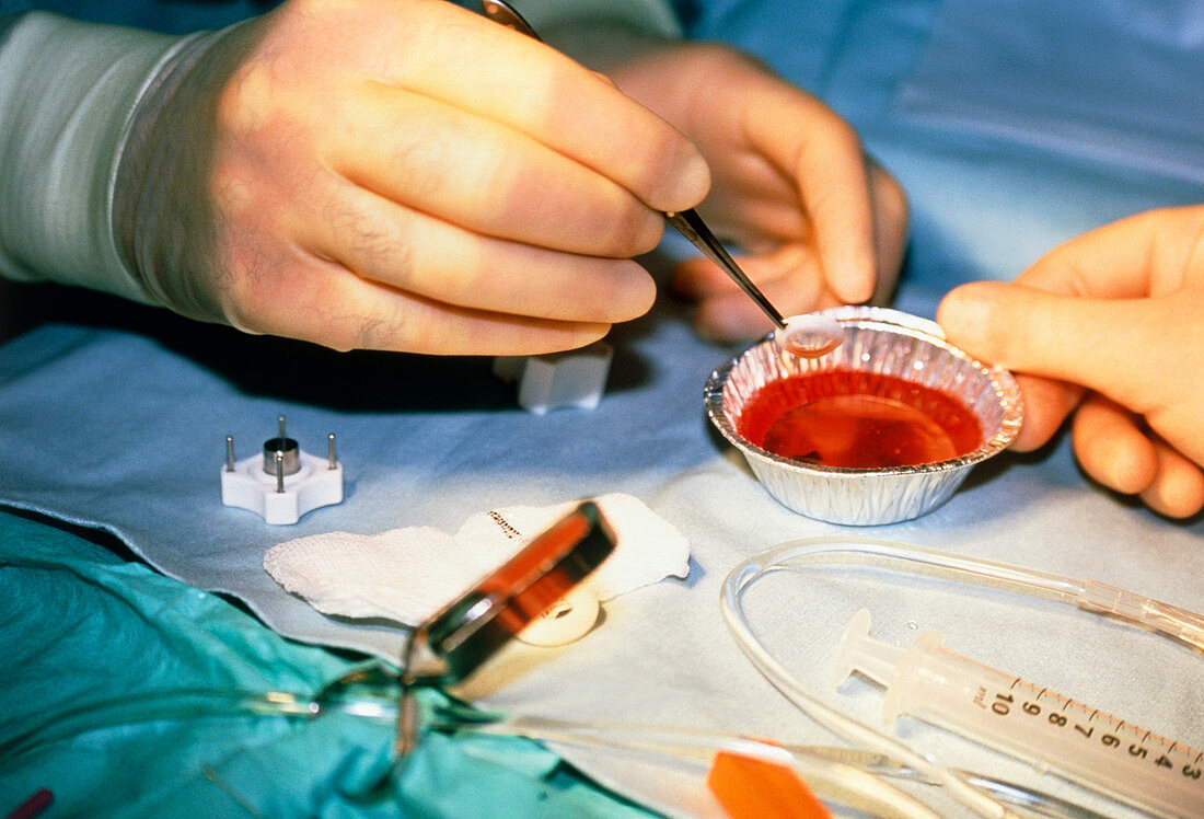 Surgical team in operating theatre