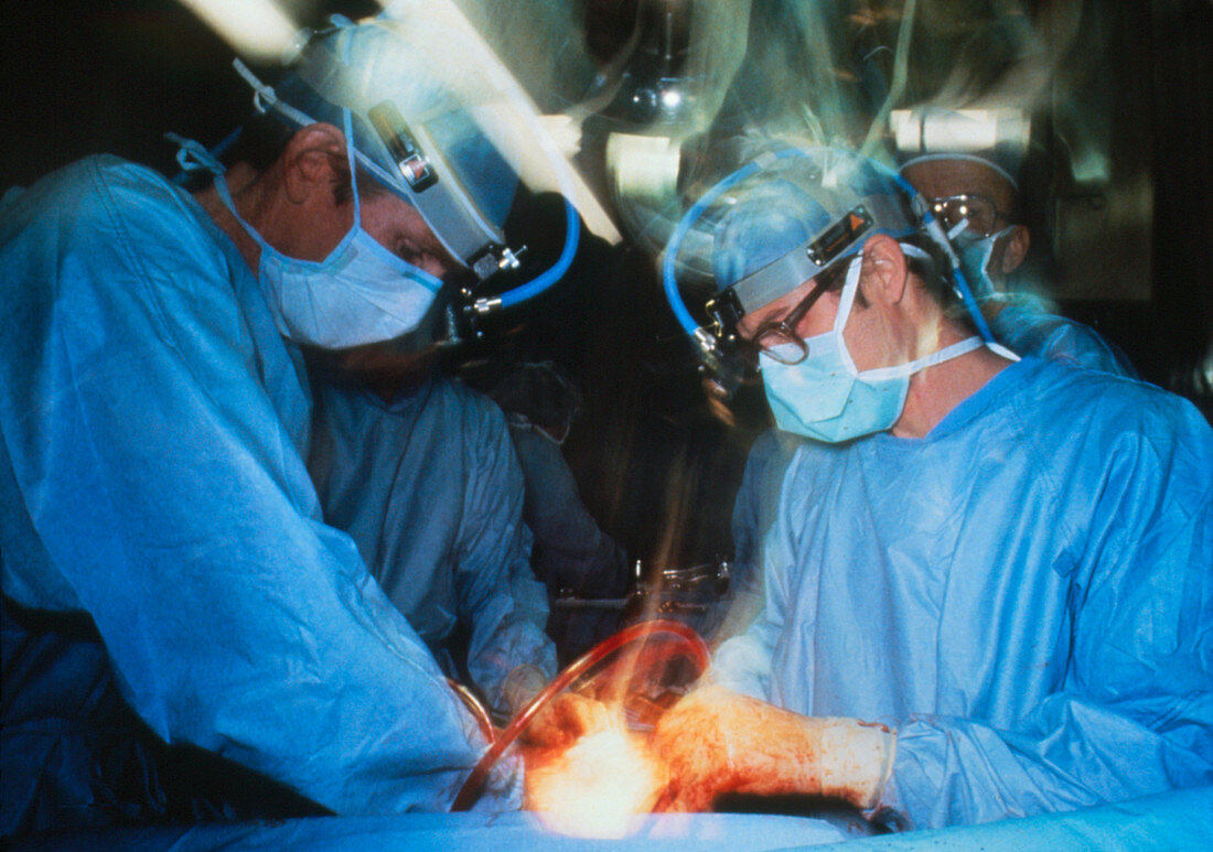 First implantation of an artificial heart