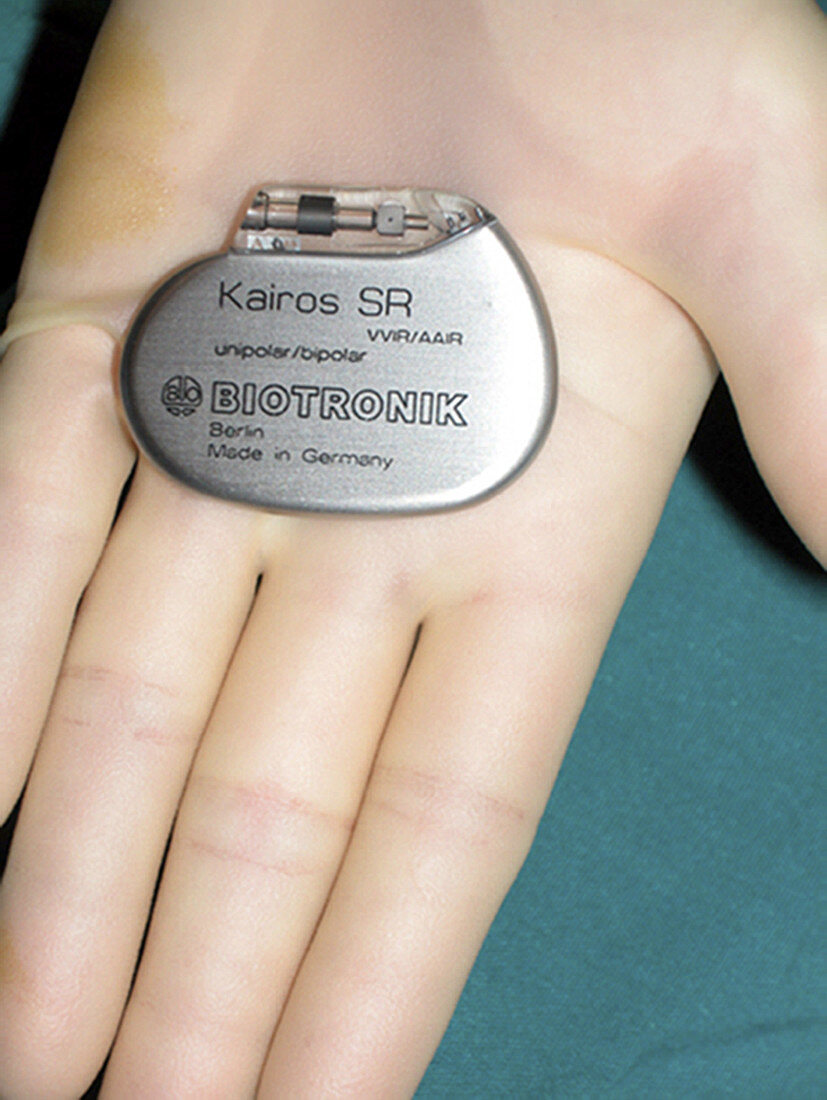 Pacemaker in surgeons hand
