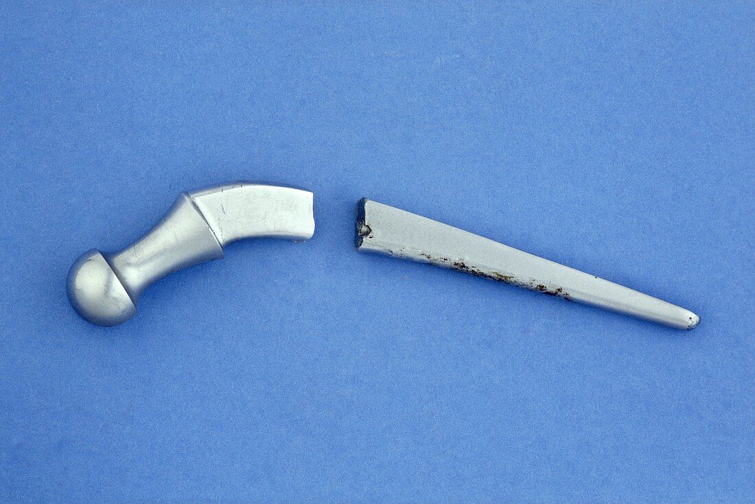 Hip prosthesis with a broken shaft
