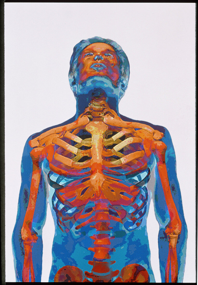 Artwork of the upper part of a male human skeleton