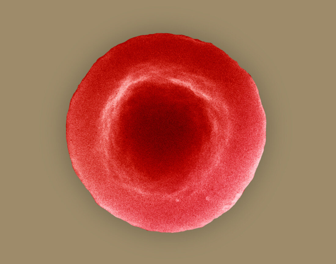 Normal red blood cell