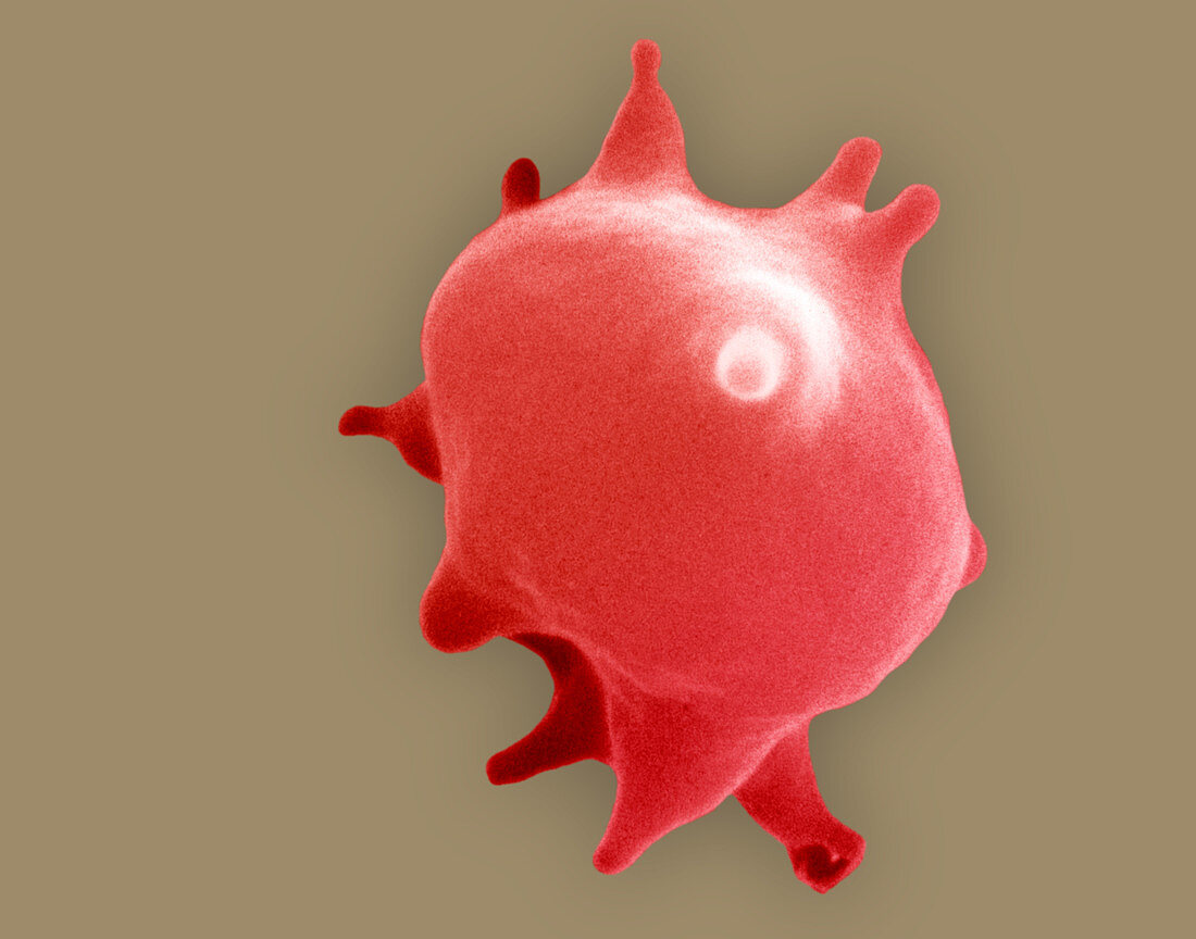 Red blood cell in hypertonic solution