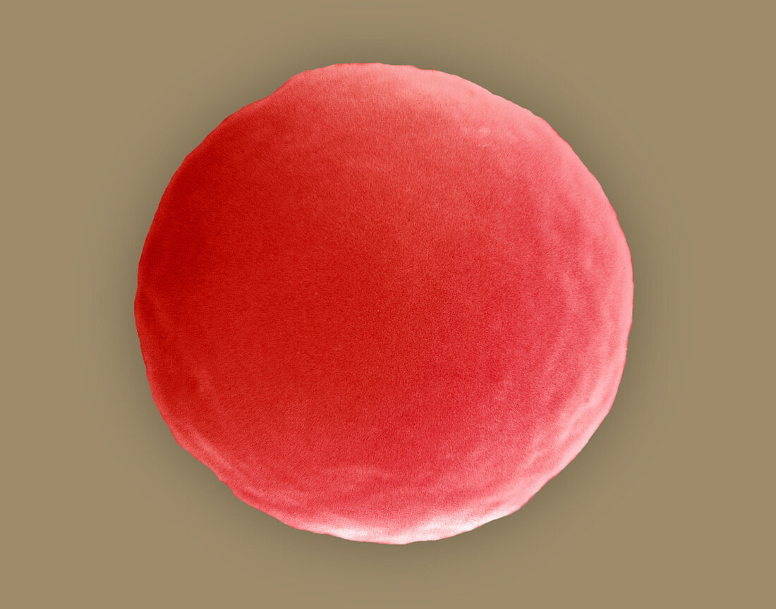 Red blood cell in hypotonic solution