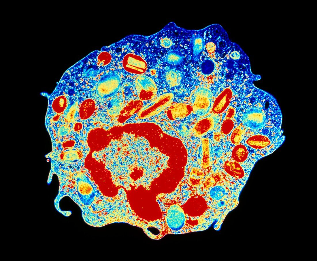 Coloured TEM of a human eosinophil (granulocyte)