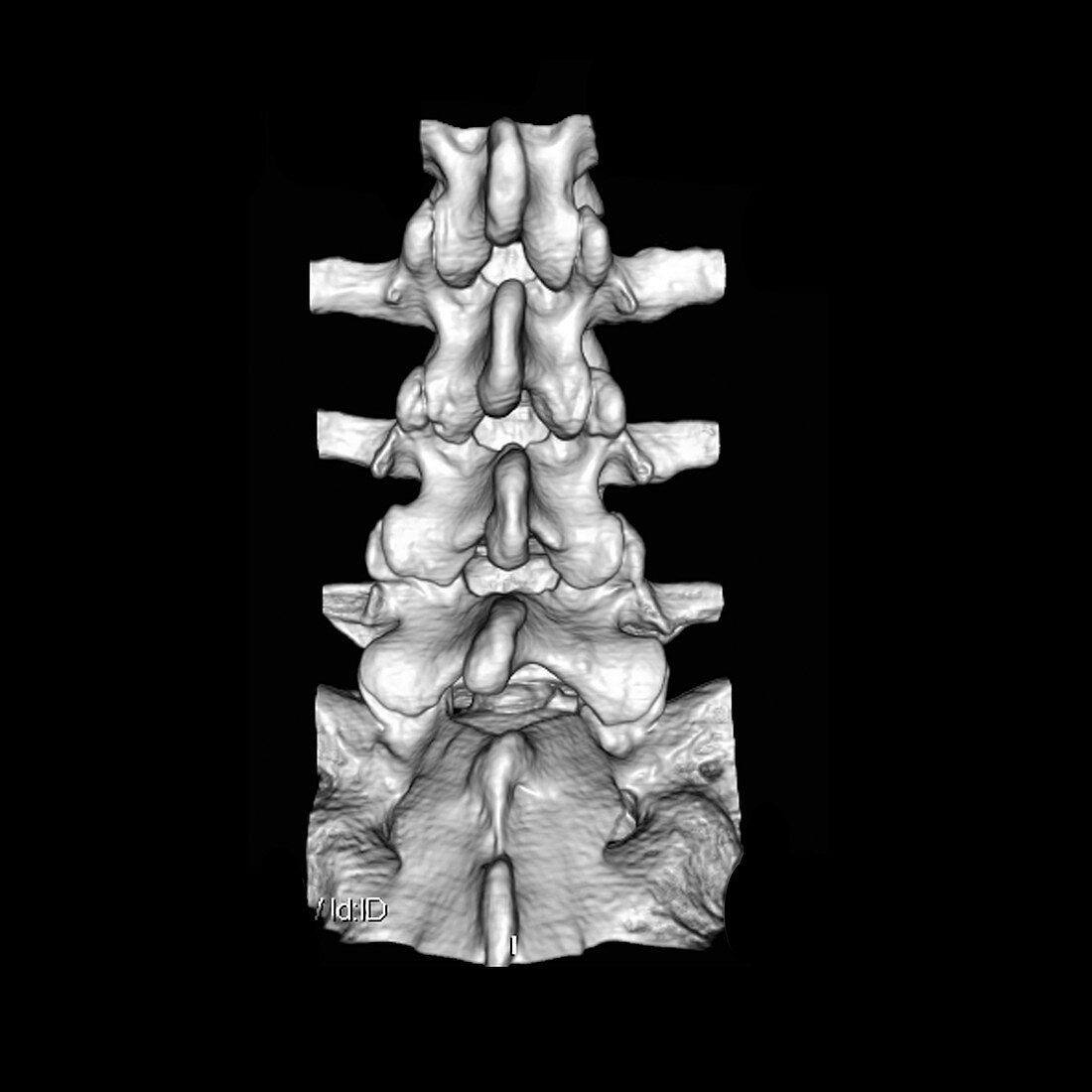 View of Lumbar Spine