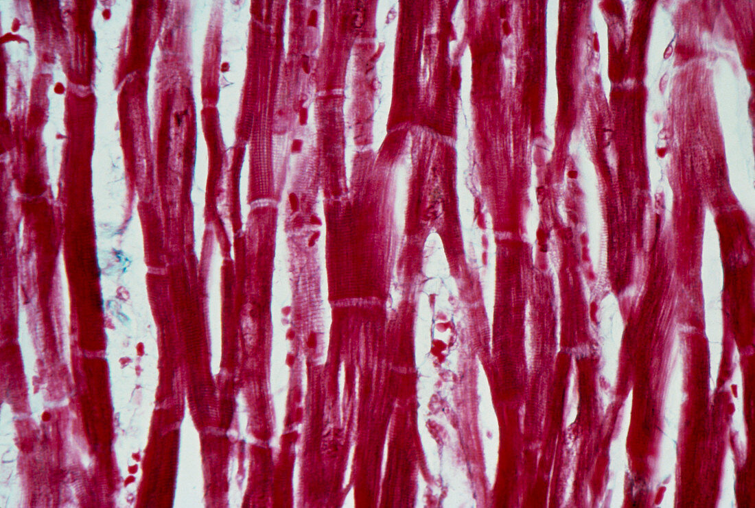 LM of normal human cardiac muscle fibres