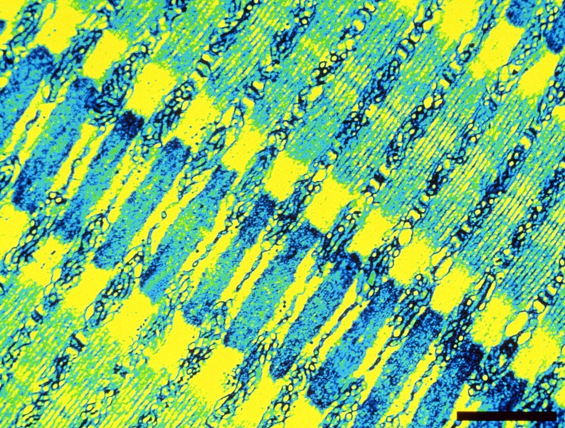 Coloured TEM of skeletal (striated) muscle of fish