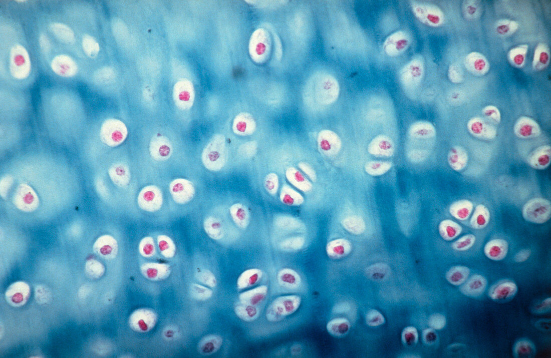 Photomicrograph of hyaline cartilage