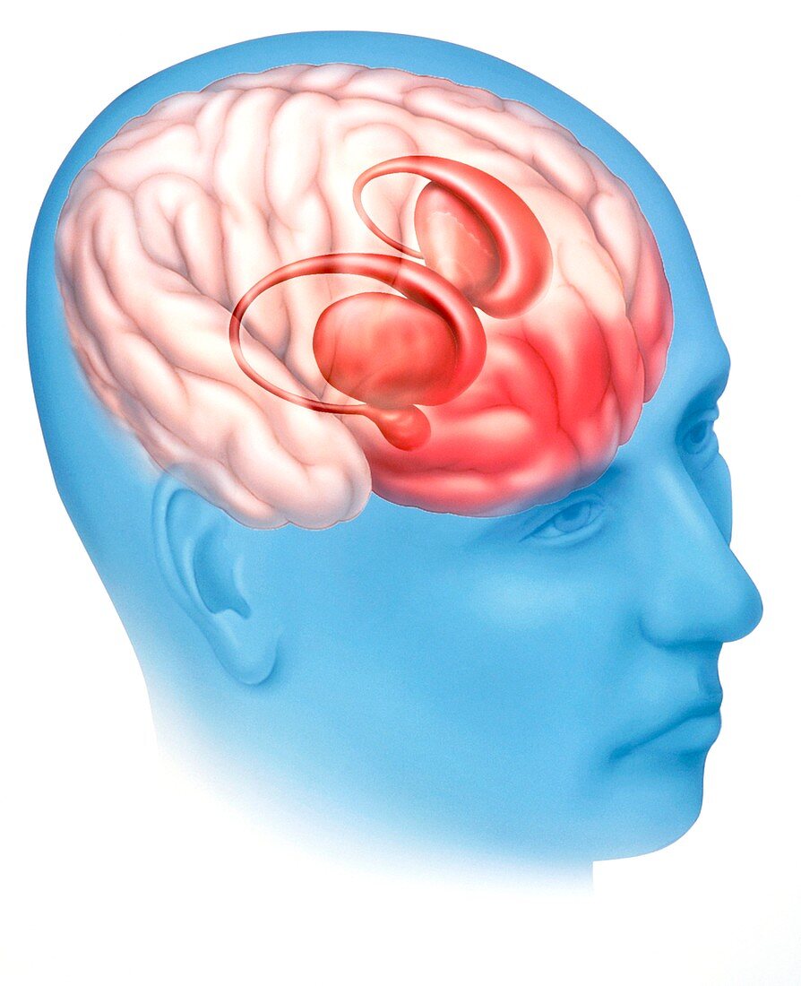 Artwork of basal ganglia in brain's limbic system