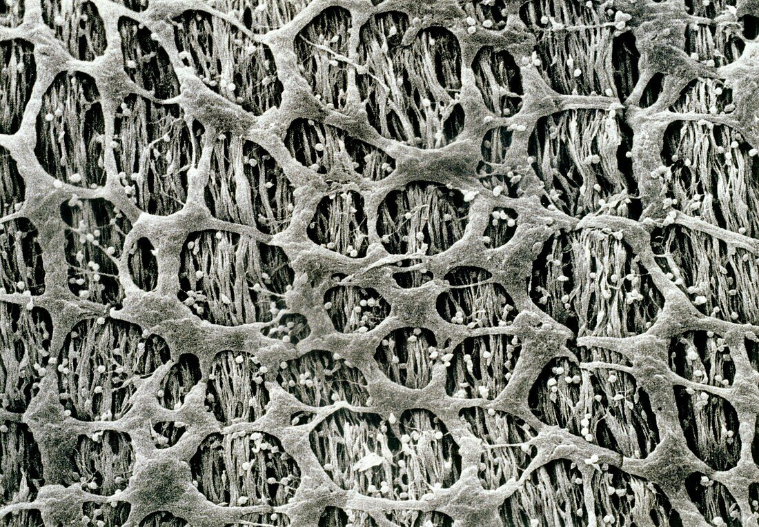 SEM of nerve fibres in intestinal myenteric plexus