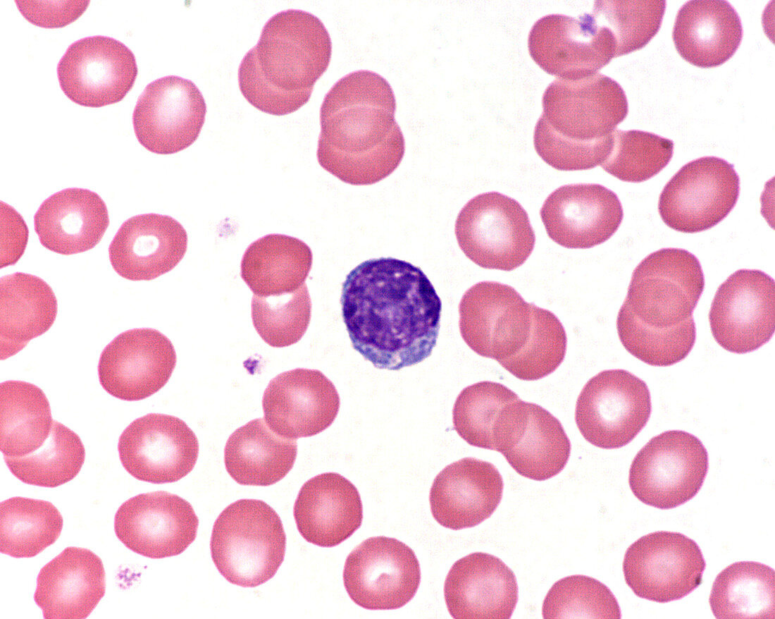 Medium sized lymphocyte