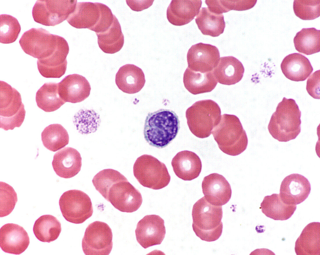 Small lymphocyte