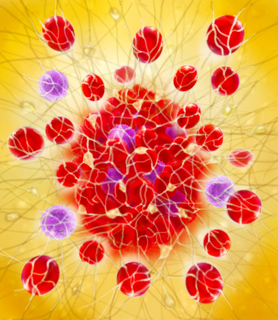 Close-up illustration of a blood clot