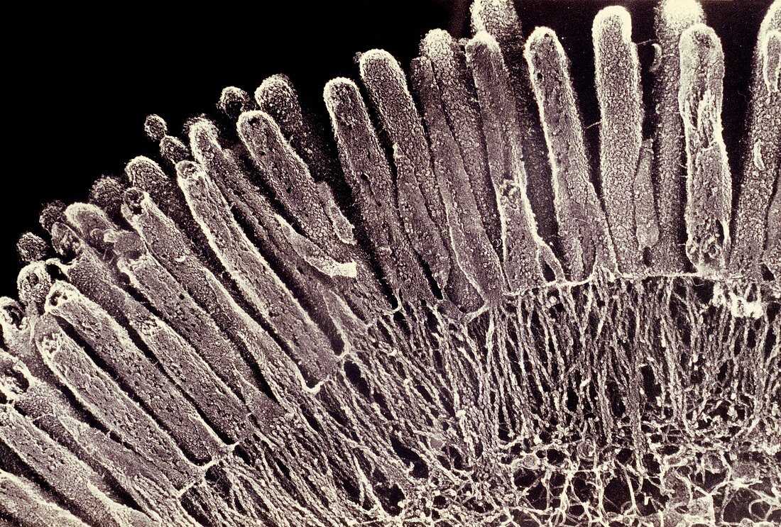 SEM of an absorptive cell in the small intestine
