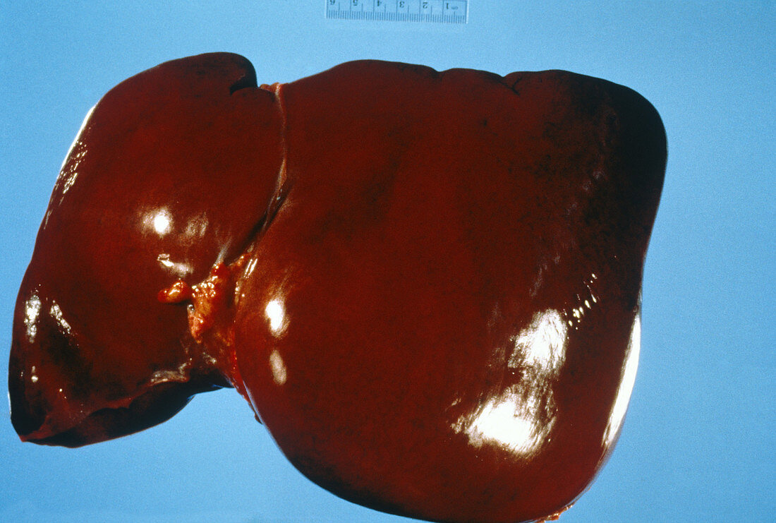 Human Liver