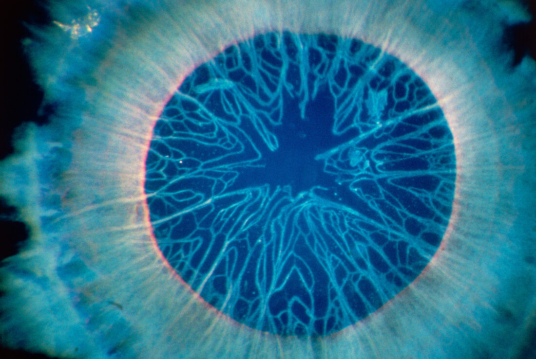 Macrophoto of an human foetal eye