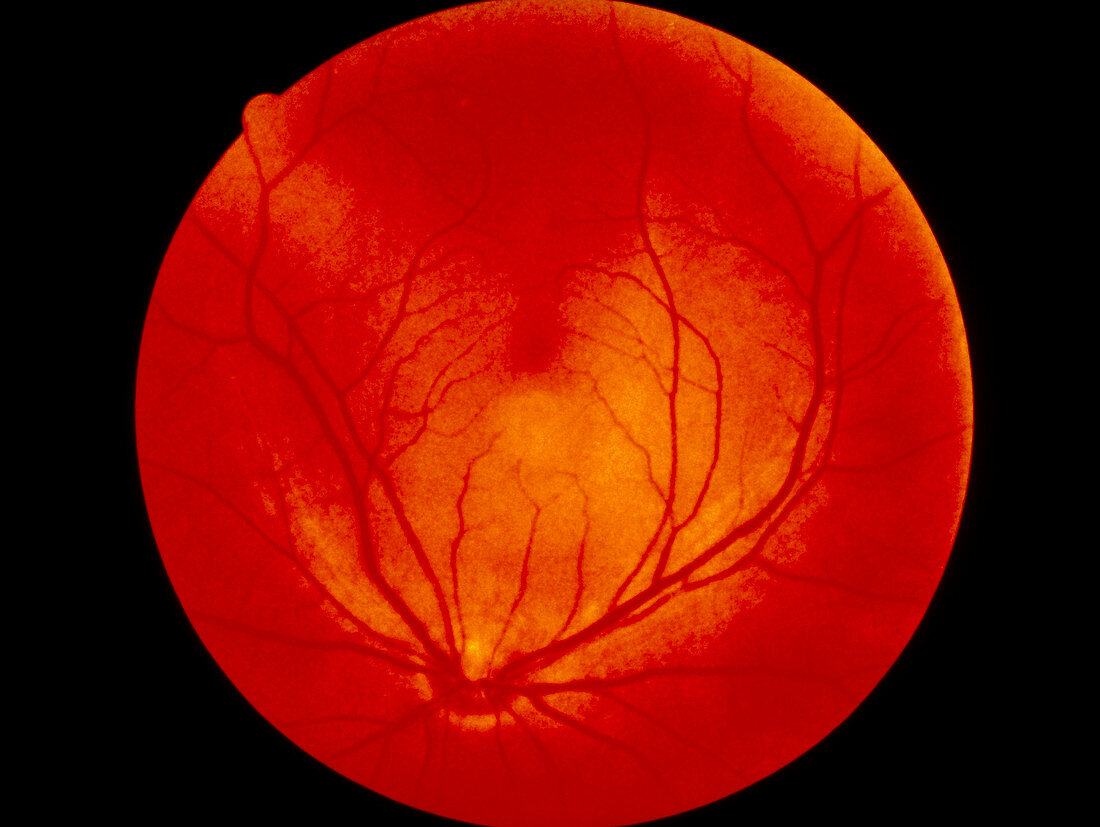 Retina of the eye